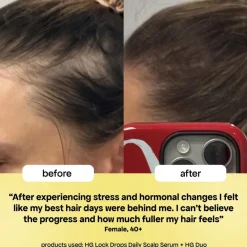 Bondi Boost HG Lock Drops For Thinning Hair päänahkaseerumi 30 ml