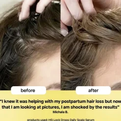 Bondi Boost HG Lock Drops For Thinning Hair päänahkaseerumi 30 ml