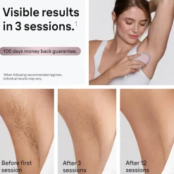 Braun Silk-Expert Mini IPL1100 -laserlaite
