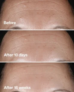 Clinique Smart Clinical Repair Seerumi 30 ml