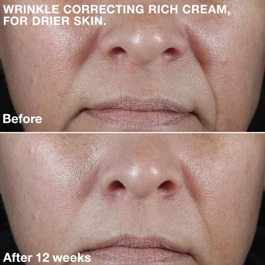 Clinique Smart Clinical Repair Wrinkle Correcting Rich Cream kosteusvoide 50 ml
