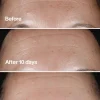 Clinique Smart Clinical Repair Seerumi 50 ml