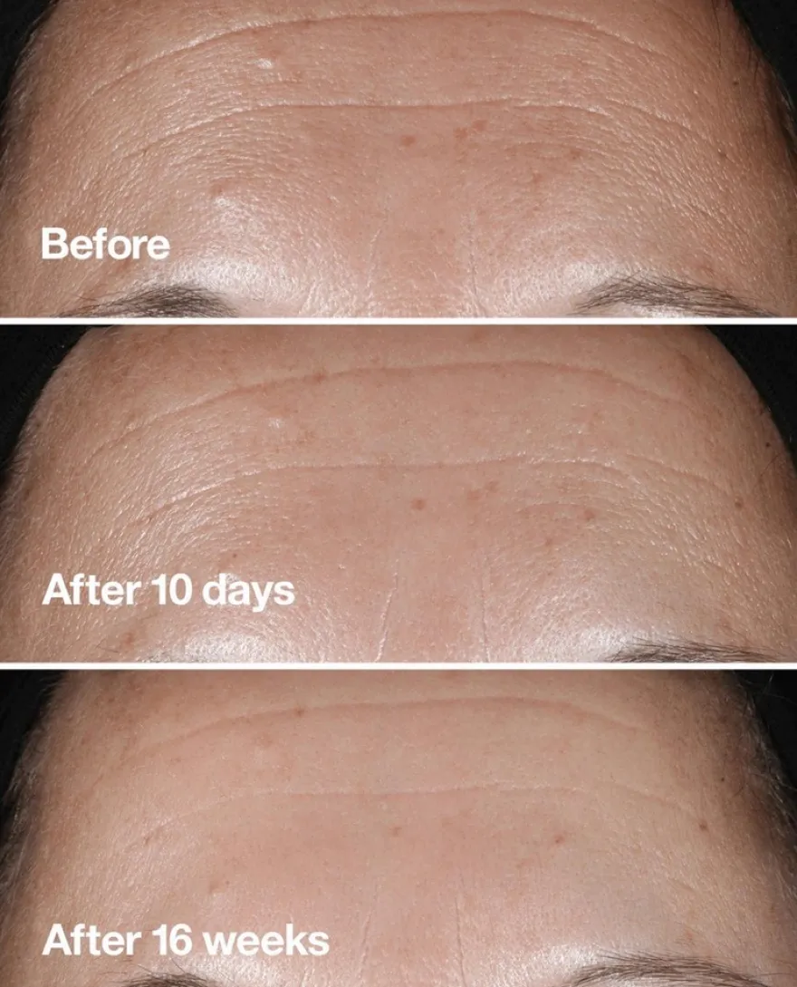 Clinique Smart Clinical Repair Seerumi 50 ml