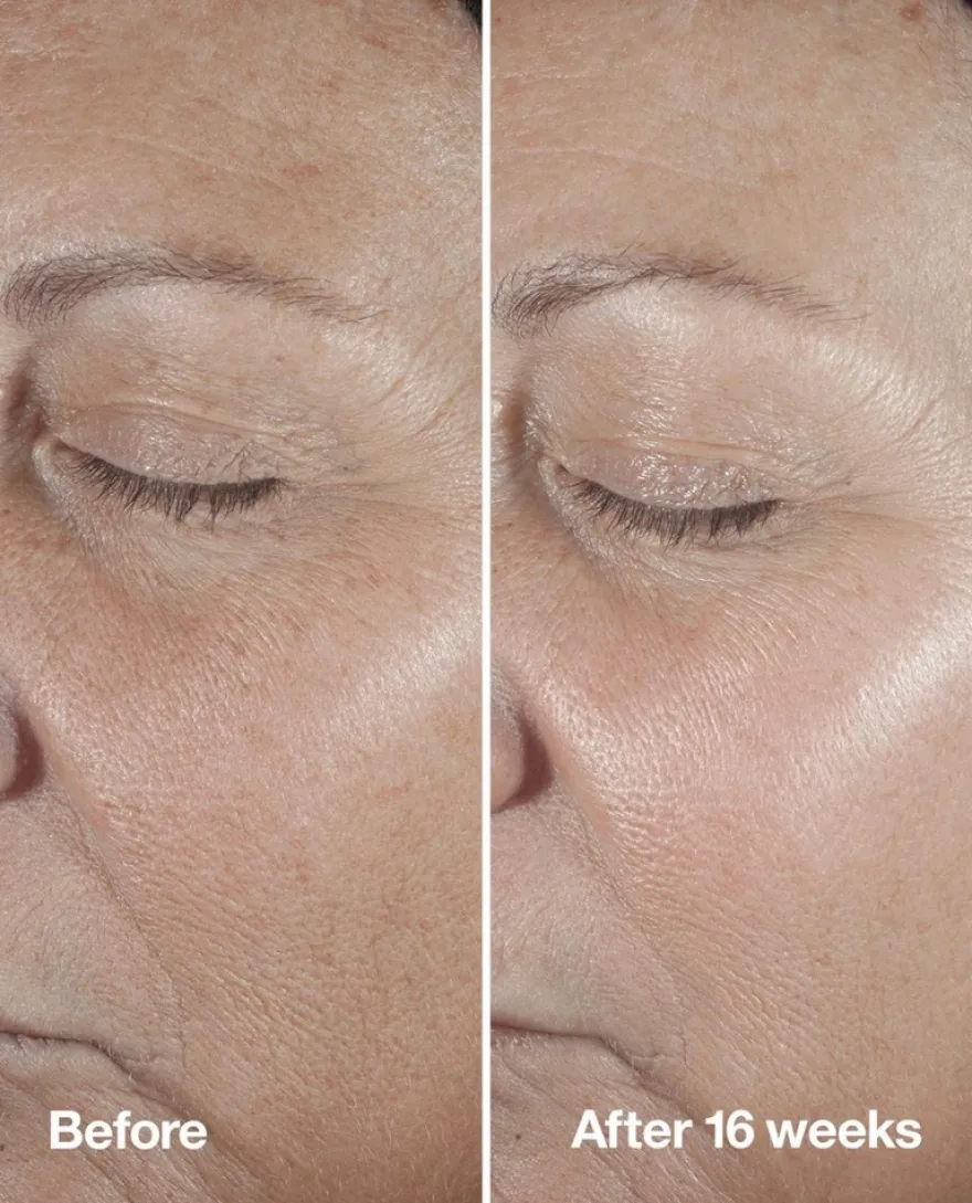 Clinique Smart Clinical Repair Seerumi 50 ml