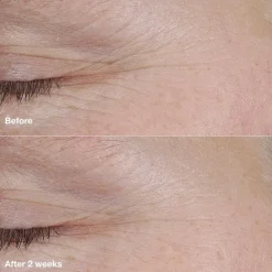 Clinique Smart Clinical Repair AM/PM Retinoid Balm täsmähoitotuote 3 g