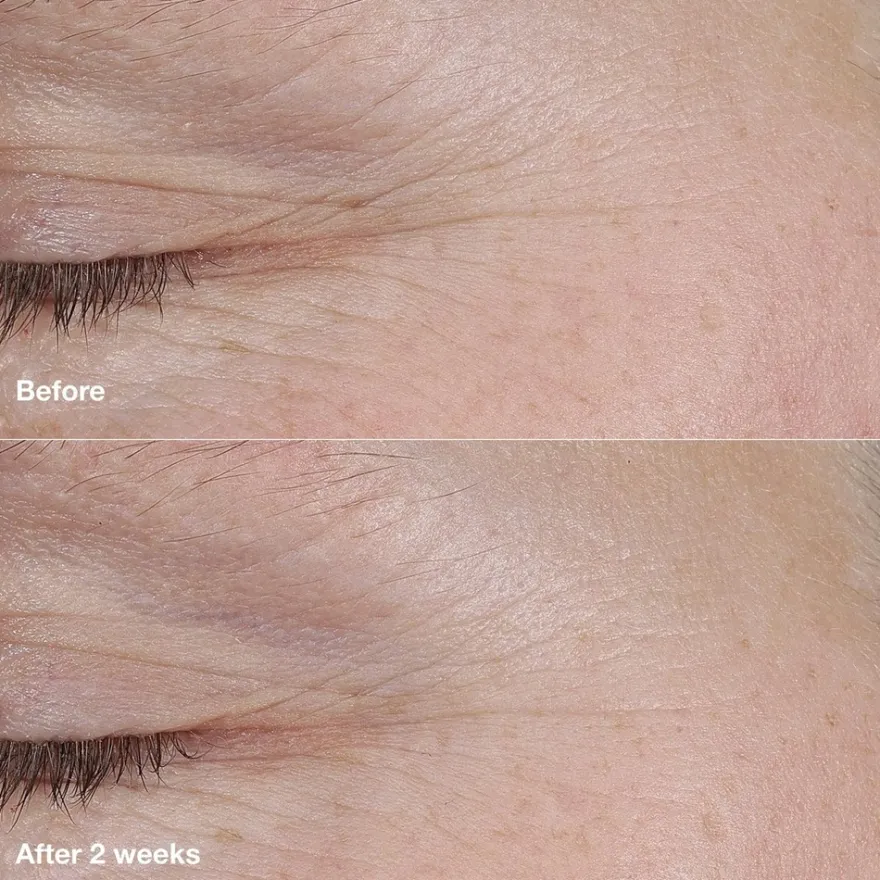Clinique Smart Clinical Repair AM/PM Retinoid Balm täsmähoitotuote 3 g