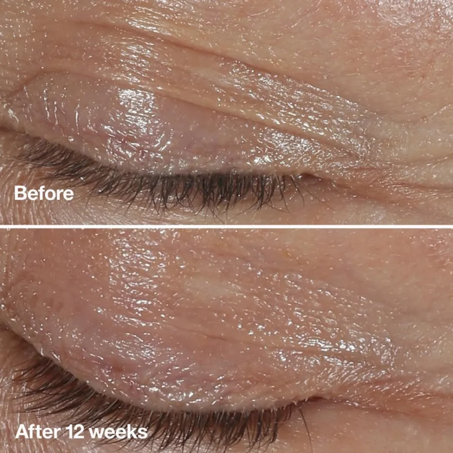 Clinique Smart Clinical Repair Wrinkle Correcting Eye Cream silmänympärysvoide 15 ml