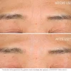 DIOR Capture Totale Retishot Retinol Skin Quality Renewer yötiiviste 20 ml