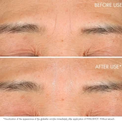 DIOR Capture Totale Retishot Retinol Skin Quality Renewer yötiiviste 20 ml
