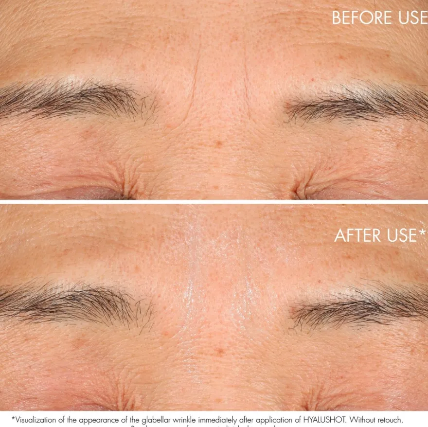 DIOR Capture Totale Retishot Retinol Skin Quality Renewer yötiiviste 20 ml
