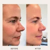 Evolve Organic Beauty Age Defying Lifting kasvoseerumi 30ml