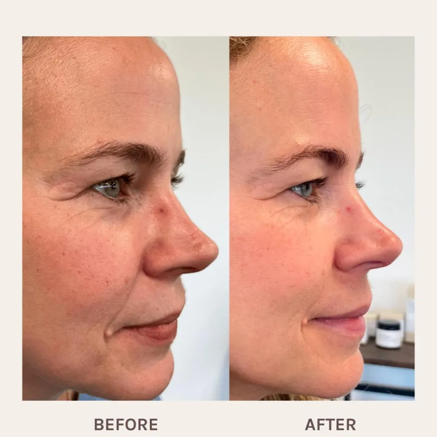 Evolve Organic Beauty Age Defying Lifting kasvoseerumi 30ml
