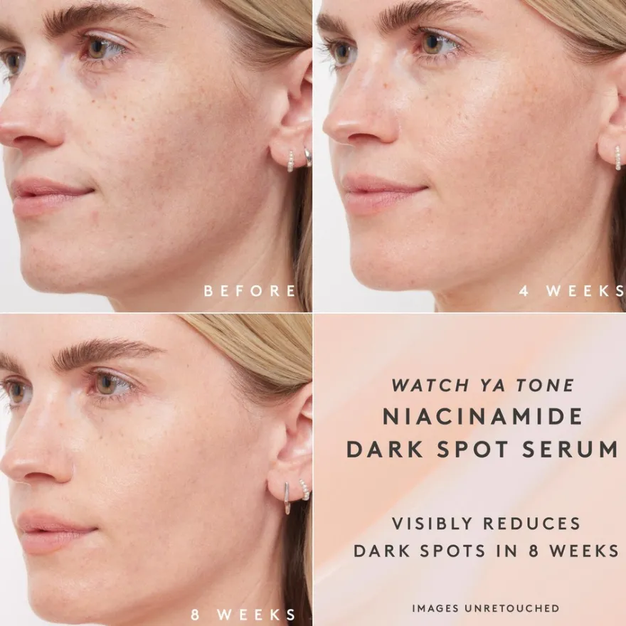Fenty Skin Watch Ya Tone Niacinamide Dark Spot Serum Refill seerumi täyttöpakkaus 30 ml