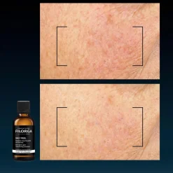 Filorga Daily Peel Dark Spot 50 ml -uudistava hoitoneste pigmenttimuutoksille