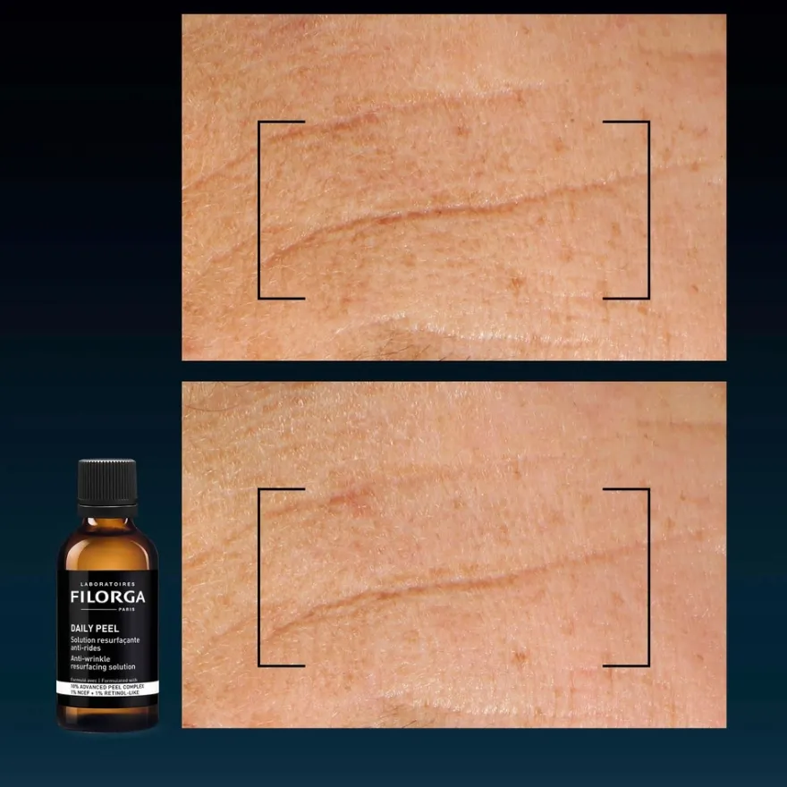 Filorga Daily Peel Wrinkles 50 ml -päivittäinen uudistava hoitoneste juonteille