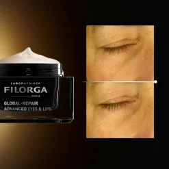 Filorga Global-Repair Advanced Eyes & Lips 15 ml -silmän- ja huultenympärysvoide