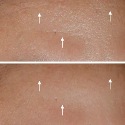 Filorga Hydra-Aox -intensiivinen antioksidantti seerumi 30 ml