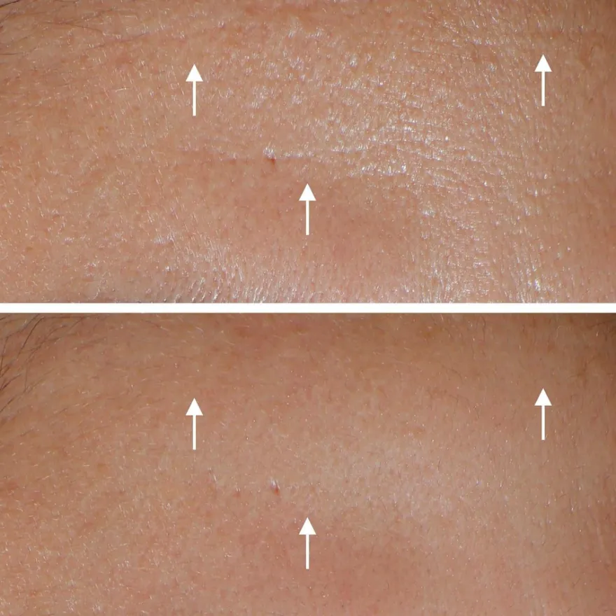Filorga Hydra-Aox -intensiivinen antioksidantti seerumi 30 ml