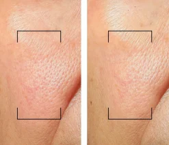 Filorga Invisible Mineral UV Moisturizer 50 ml -päivittäinen kosteuttava aurinkosuoja