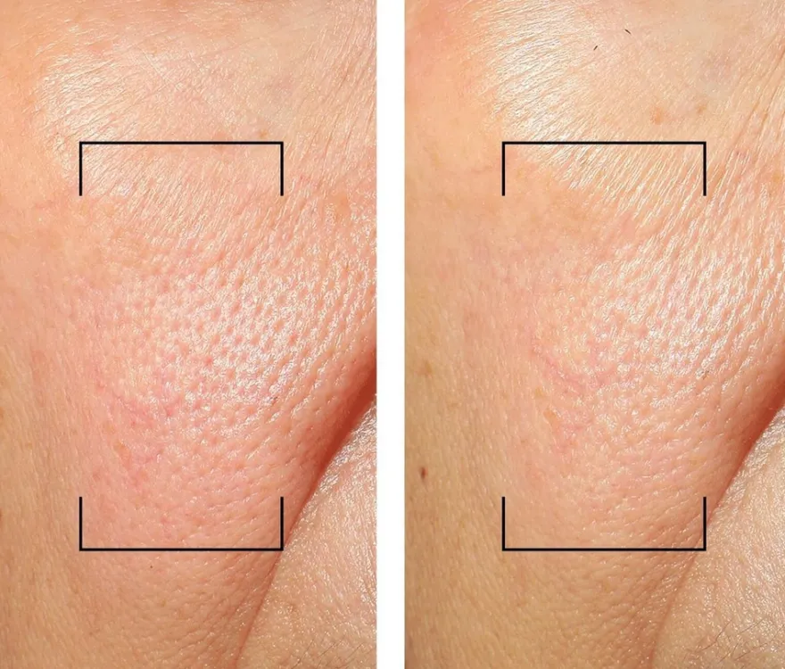 Filorga Invisible Mineral UV Moisturizer 50 ml -päivittäinen kosteuttava aurinkosuoja
