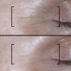 Filorga Time-Filler Shot 5XP seerumi 15 ml