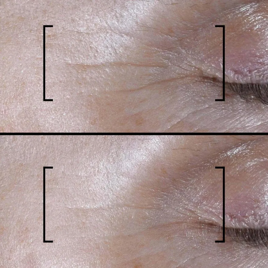 Filorga Time-Filler Shot 5XP seerumi 15 ml