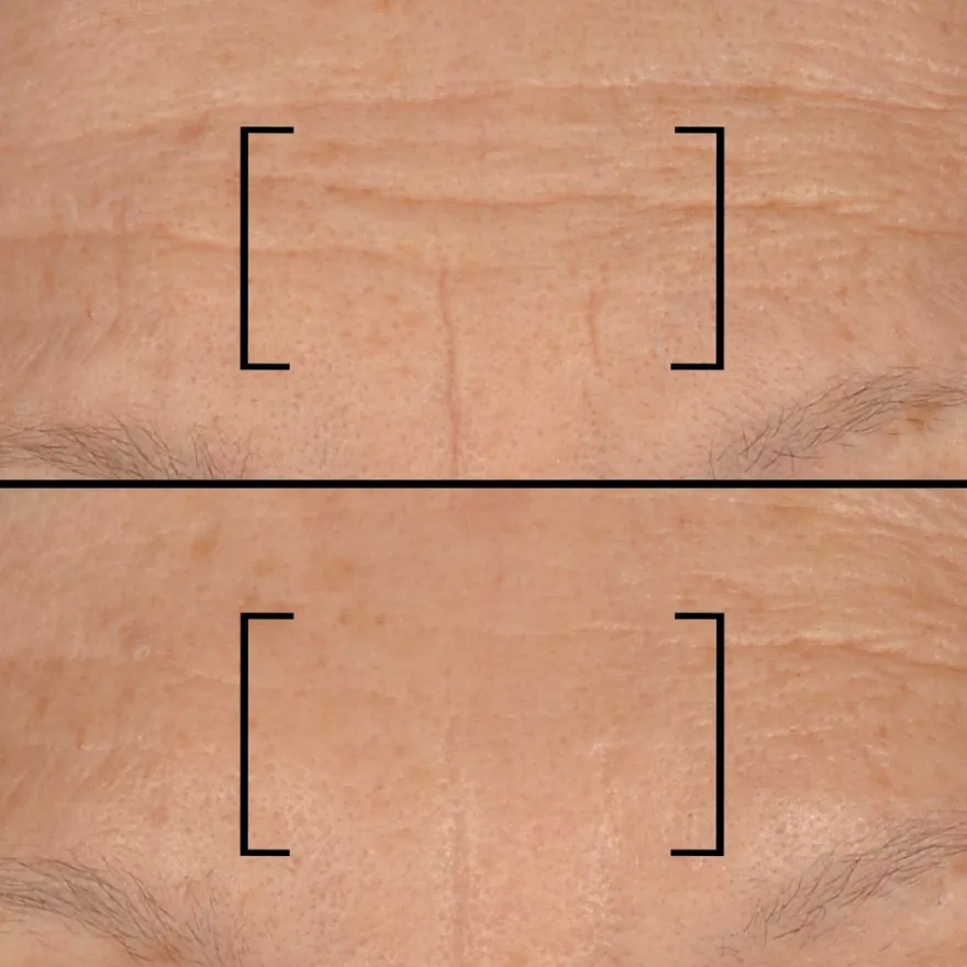 Filorga Time-Filler 5XP Cream hoitovoide 50 ml