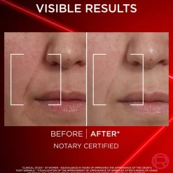 L'Oréal Paris Revitalift Laser edistyksellinen anti-age päivävoide 50ml