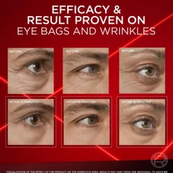 L'Oreal Paris Revitalift Laser Eye Bag Instant Eraser normaalille iholle 15 ml