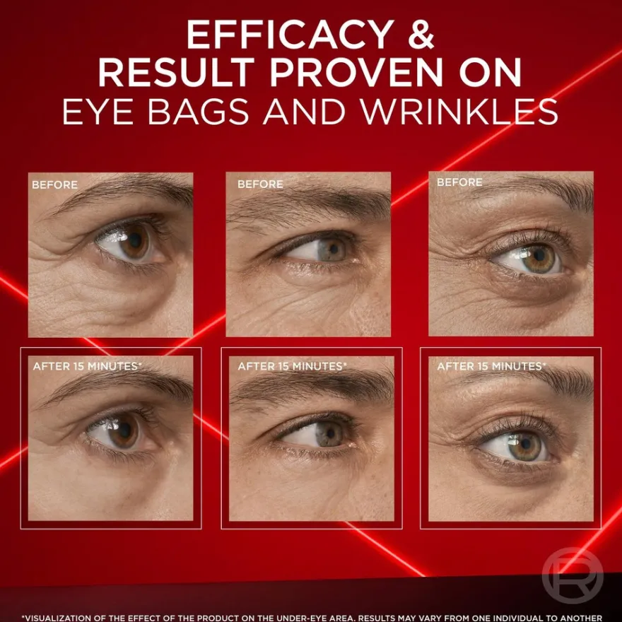 L'Oreal Paris Revitalift Laser Eye Bag Instant Eraser normaalille iholle 15 ml