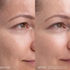 MÁDARA KOJIC ALTERNATIVE Pigment -seerumi 30ml