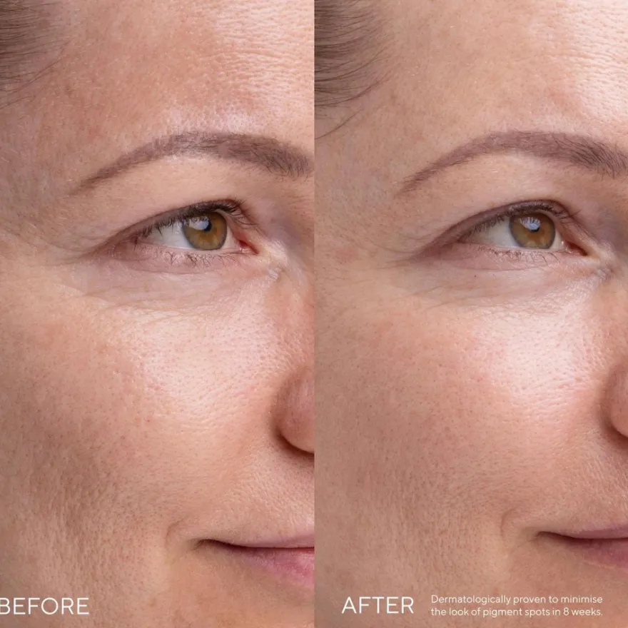 MÁDARA KOJIC ALTERNATIVE Pigment -seerumi 30ml