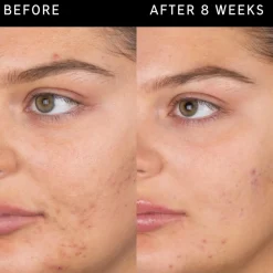 The Inkey List Salicylic Acid Cleanser puhdistusgeeli 60 ml