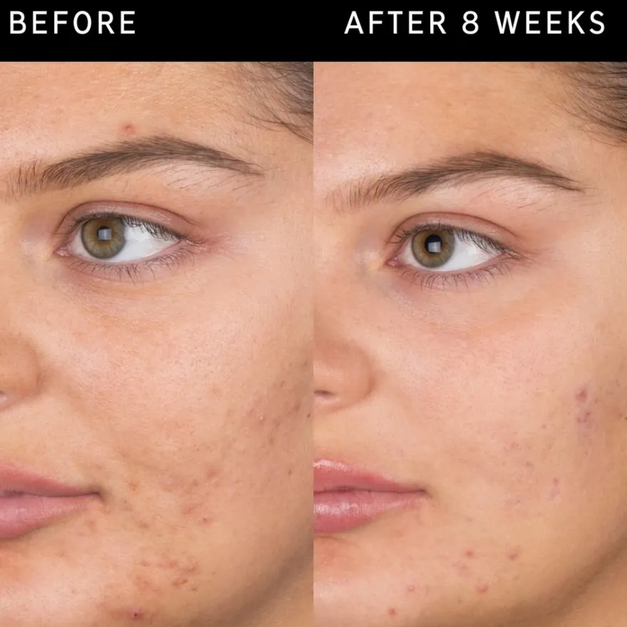 The Inkey List Salicylic Acid Cleanser puhdistusgeeli 60 ml