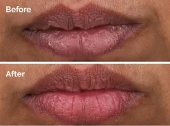 The Ordinary PHA 5% Exfoliating Lip Serum huuliseerumi 15 ml