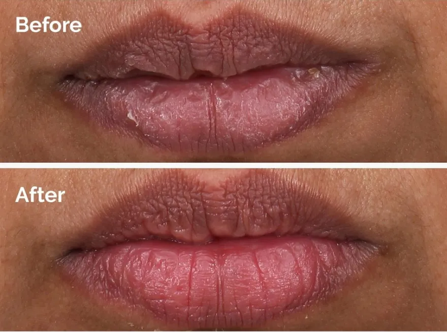 The Ordinary PHA 5% Exfoliating Lip Serum huuliseerumi 15 ml