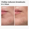 The Ordinary Sulfur 10% Powder-to-Cream Concentrate täsmätuote epäpuhtauksille 5g