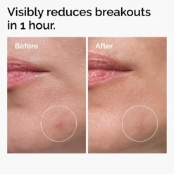 The Ordinary Sulfur 10% Powder-to-Cream Concentrate täsmätuote epäpuhtauksille 5g