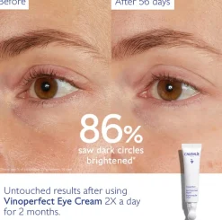 Vinoperfect Brightening Eye Cream - 15 mL