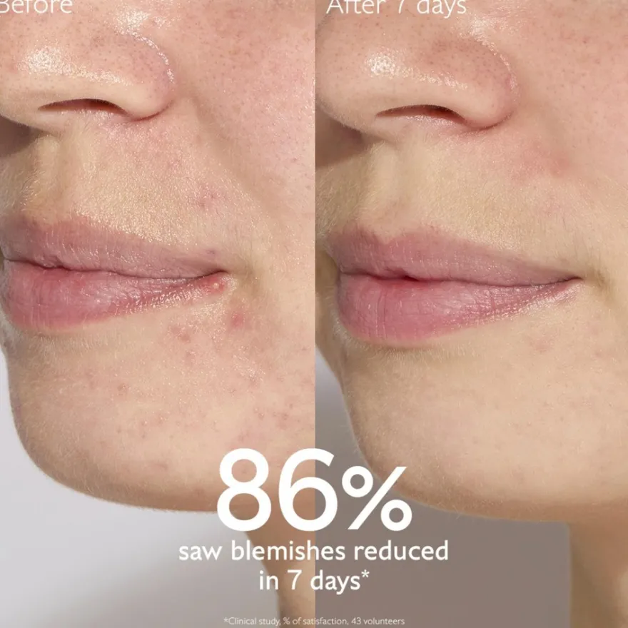 Vinopure Blemish Control Salicylic Serum